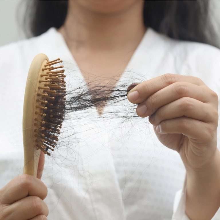 Anti-Hair Loss
